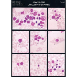 Planche de cytologie hématologique : lignées érythrocytaire et thrombocytaire de la moelle normale