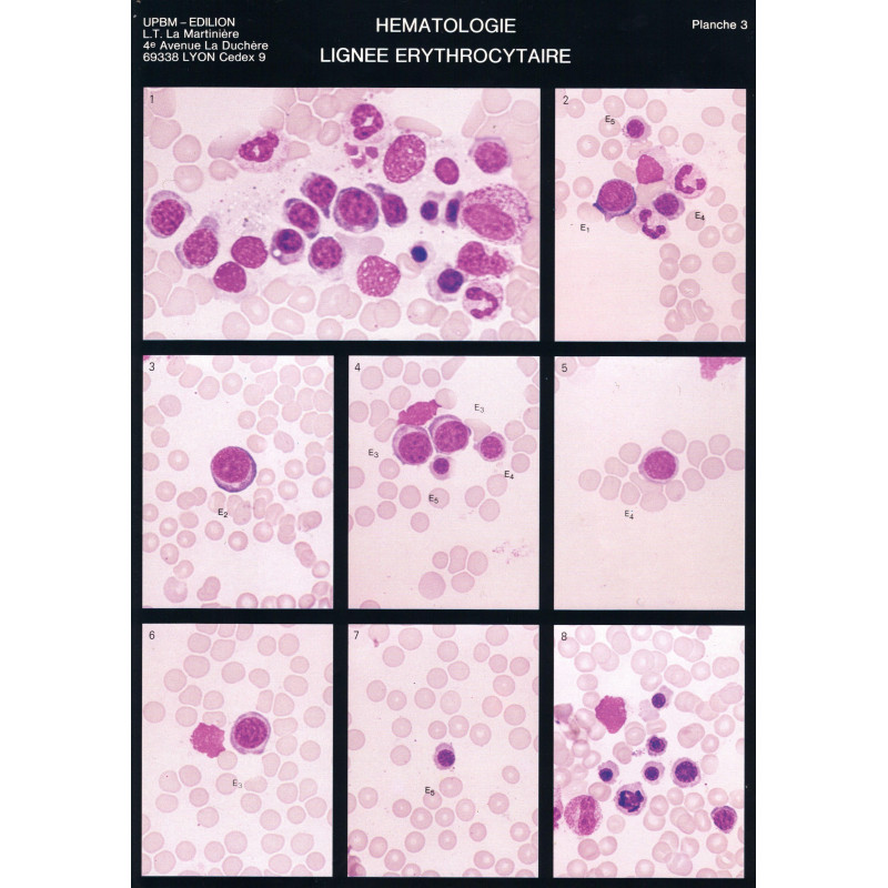 Planche de cytologie hématologique : lignées érythrocytaire et thrombocytaire de la moelle normale